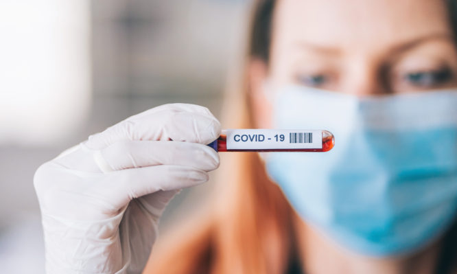 You are currently viewing Κορονοϊός: Γρήγορο τεστ αίματος δείχνει ποιος κινδυνεύει περισσότερο με σοβαρή COVID-19